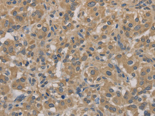 AGTRAP Polyclonal Antibody Store at -20°C