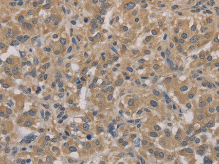 AGTRAP Polyclonal Antibody Store at -20°C