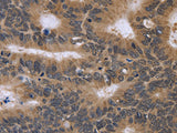 FGFR1OP2 Polyclonal Antibody Store at -20°C