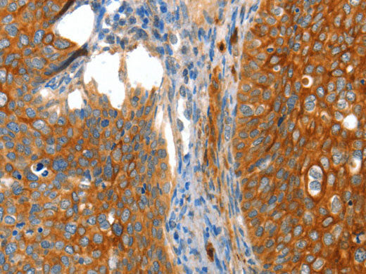 VWA5A Polyclonal Antibody Store at -20°C