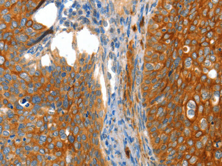VWA5A Polyclonal Antibody Store at -20°C
