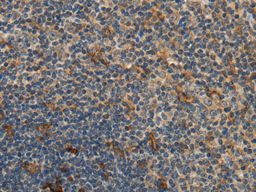 GGT1 Polyclonal Antibody Store at -20°C