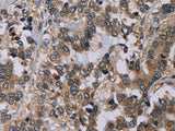 NECTIN4 Polyclonal Antibody Store at -20°C