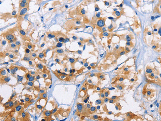 CAPZA3 Polyclonal Antibody Store at -20°C