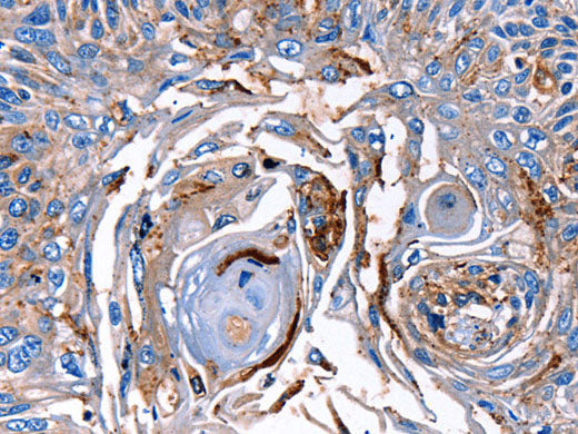 LRP2 Polyclonal Antibody Store at -20°C