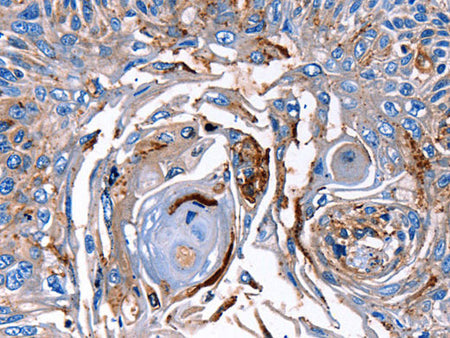 LRP2 Polyclonal Antibody Store at -20°C