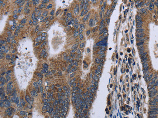 GSTA3 Polyclonal Antibody Store at -20°C