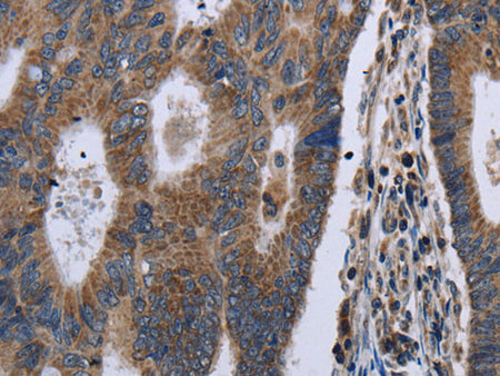 GSTA3 Polyclonal Antibody Store at -20°C