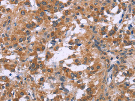 GNPAT Polyclonal Antibody Store at -20°C