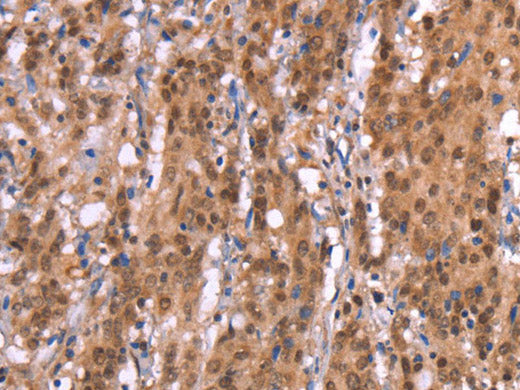 AMER1 Polyclonal Antibody Store at -20°C