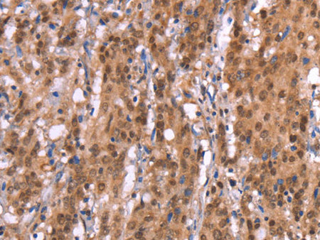 AMER1 Polyclonal Antibody Store at -20°C