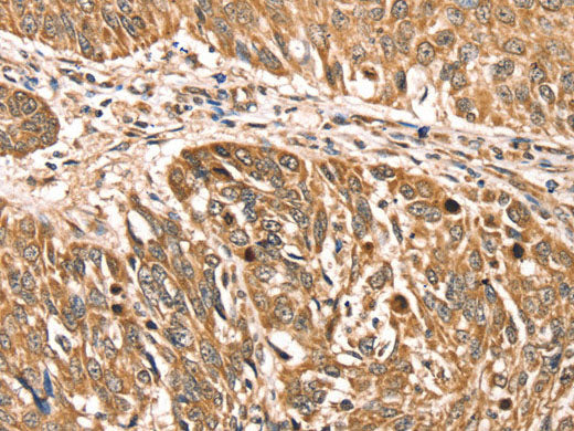 RPLP2 Polyclonal Antibody Store at -20°C