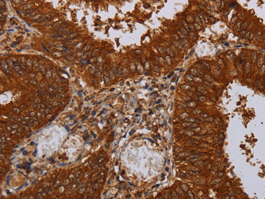 MFAP3L Polyclonal Antibody Store at -20°C