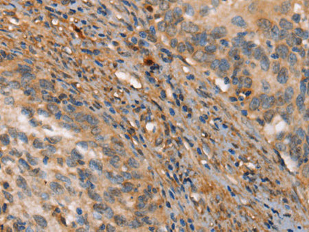 HK3 Polyclonal Antibody Store at -20°C