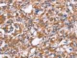 GPC6 Polyclonal Antibody Store at -20°C