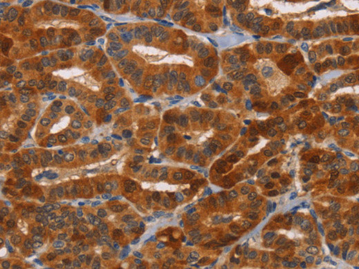 NCR1 Polyclonal Antibody Store at -20°C