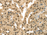DFFA Polyclonal Antibody