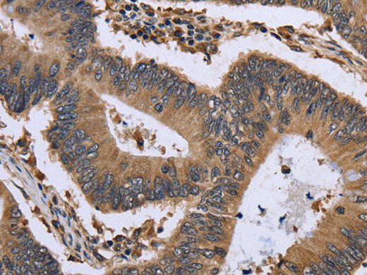 GADD45B Polyclonal Antibody Store at -20°C