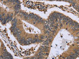 GADD45B Polyclonal Antibody Store at -20°C