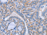 CD36 Polyclonal Antibody Store at -20°C