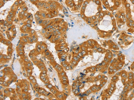 PDP1 Polyclonal Antibody Store at -20°C