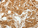 TGF β Receptor I Polyclonal Antibody Store at -20°C