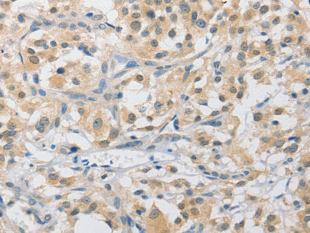 APLF Polyclonal Antibody Store at -20°C