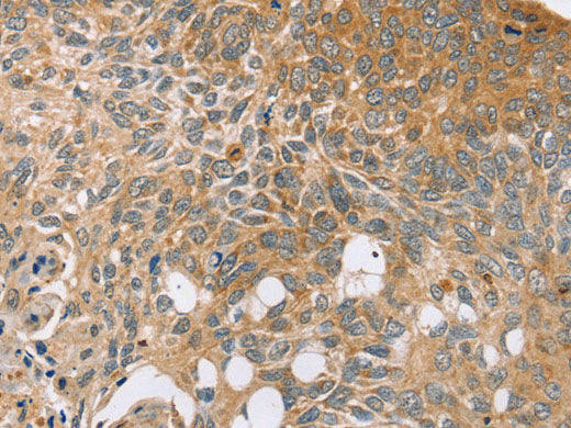 SYTL5 Polyclonal Antibody