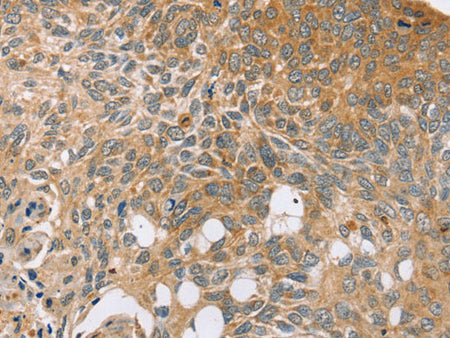 SYTL5 Polyclonal Antibody