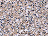 NR1D1 Polyclonal Antibody