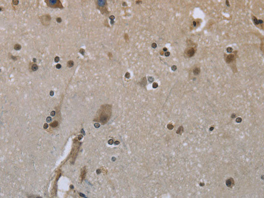 GYS1 Polyclonal Antibody Store at -20°C