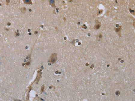 GYS1 Polyclonal Antibody Store at -20°C
