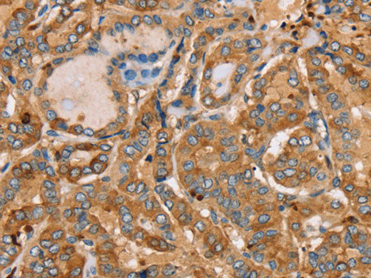 PLS3 Polyclonal Antibody Store at -20°C