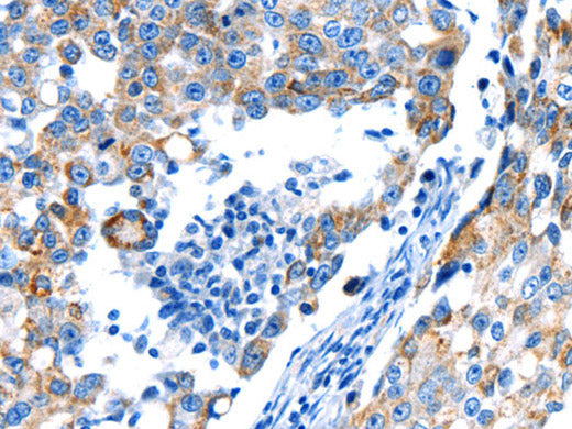 POMC Polyclonal Antibody Store at -20°C