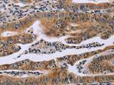 FAF1 Polyclonal Antibody Store at -20°C