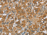 FOXB1 Polyclonal Antibody Store at -20°C