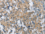 BMPR1B Polyclonal Antibody Store at -20°C