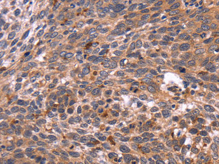 CRK Polyclonal Antibody Store at -20°C