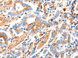 MAP2K2 Polyclonal Antibody
