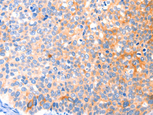 CCDC88A Polyclonal Antibody Store at -20°C