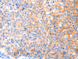 CCDC88A Polyclonal Antibody Store at -20°C