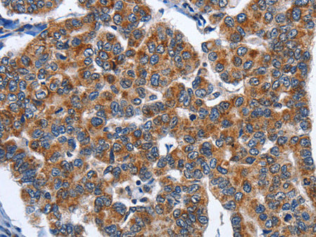 CADM3 Polyclonal Antibody Store at -20°C