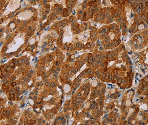 MTUS1 Polyclonal Antibody Store at -20°C