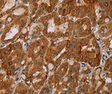 MTUS1 Polyclonal Antibody Store at -20°C