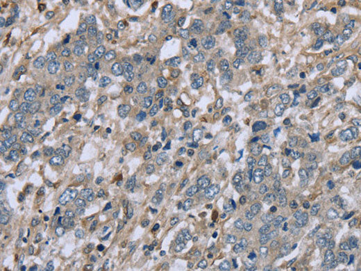 FAP Polyclonal Antibody Store at -20°C