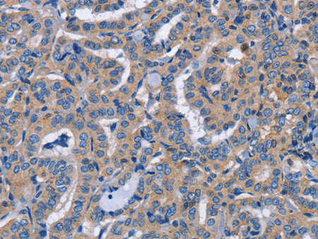 NCR2 Polyclonal Antibody Store at -20°C