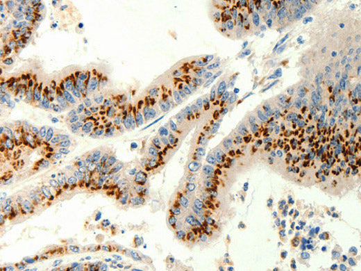 TRPC6 Polyclonal Antibody Store at -20°C