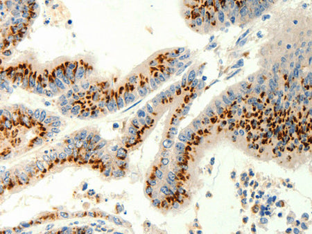 TRPC6 Polyclonal Antibody Store at -20°C
