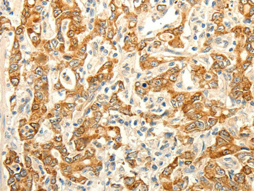ERG Polyclonal Antibody Store at -20°C