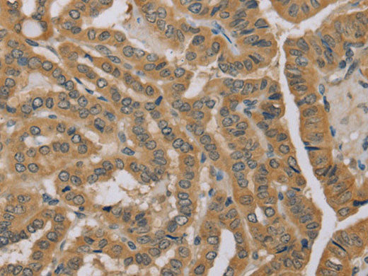 MVK Polyclonal Antibody